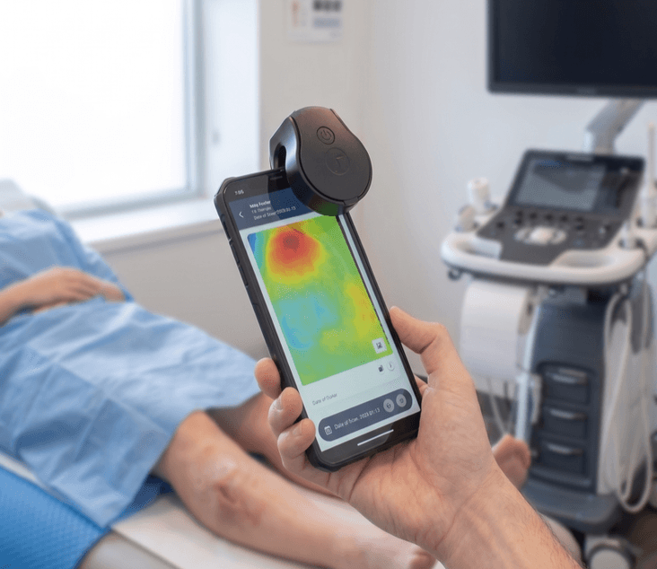 Swift thermal imaging photography